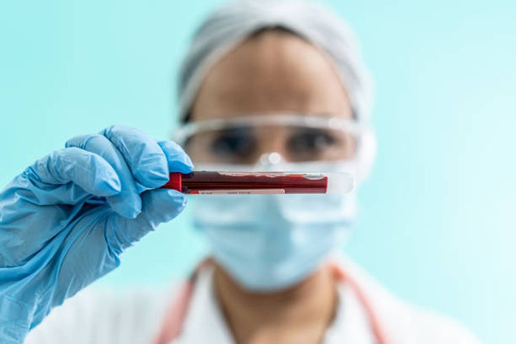 Prospek Cerah! Mengenal Jurusan Teknologi Bank Darah