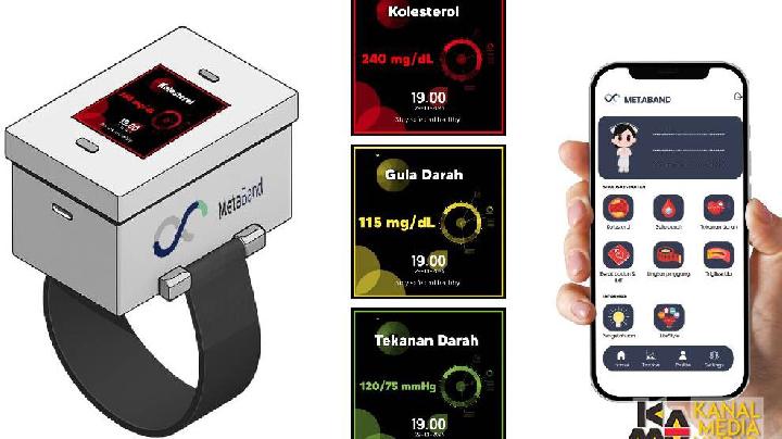 MetaBand, Smartband Canggih Buatan Mahasiswa Unpad
