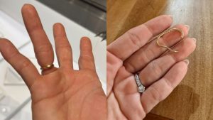 Usai Jari Terjepit Pintu, Jennifer Bachdim Minta Bantuan Damkar Untuk Lepas Cincin Kawinnya (Instagram/@jenniferbachdim)